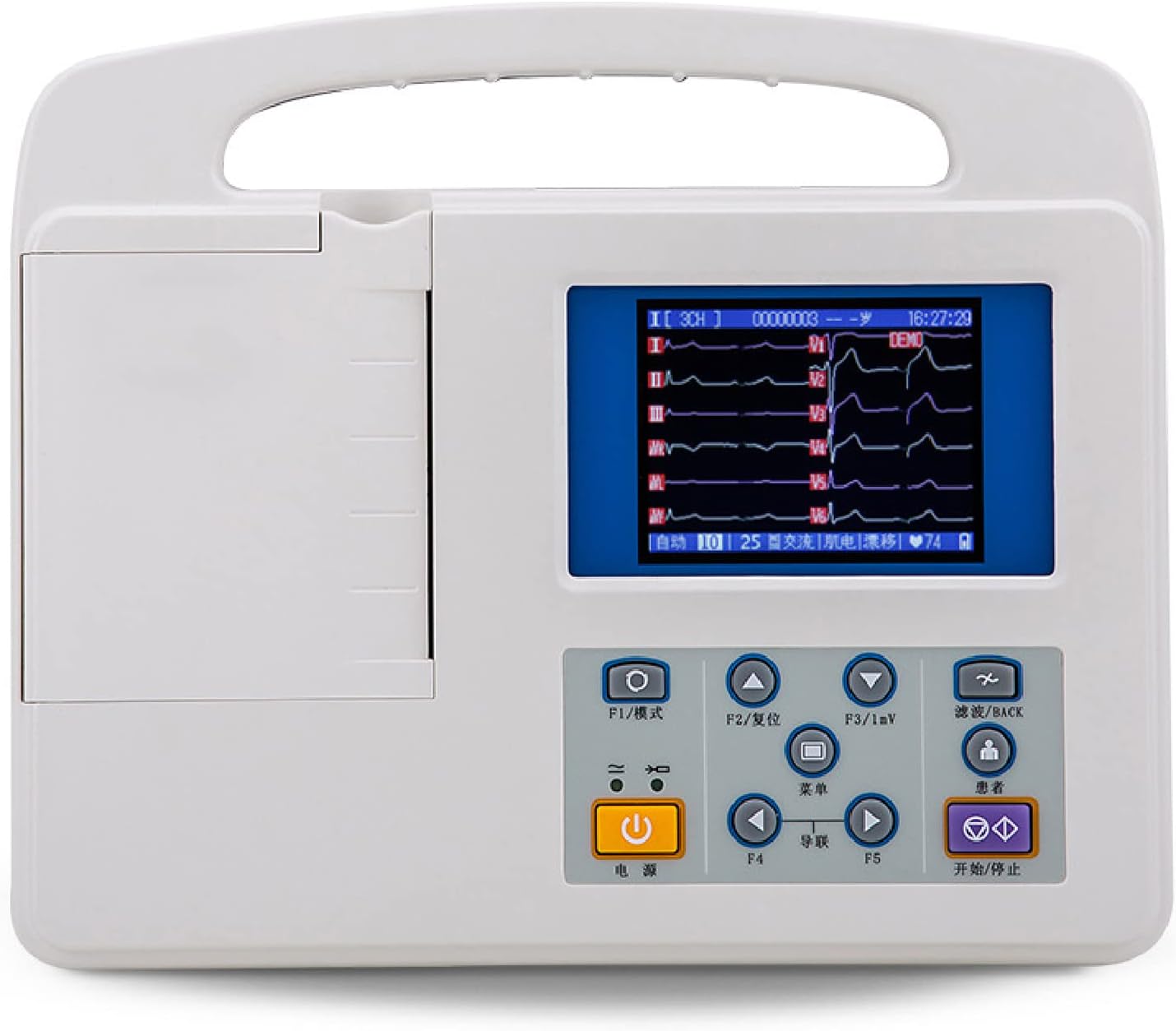 Portable ECG Monitor